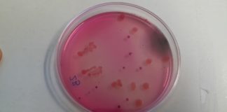 Susret s bakterijama