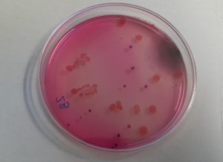 Susret s bakterijama