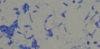 Mikrobiolog-i-ja: mikrodetektivi i mikroskop