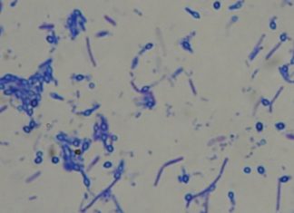 Mikrobiolog-i-ja: mikrodetektivi i mikroskop